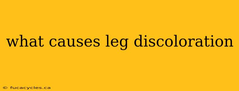 what causes leg discoloration