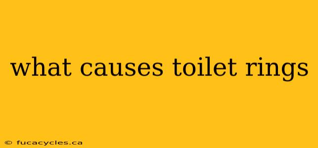 what causes toilet rings