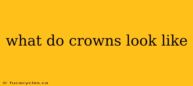 what do crowns look like