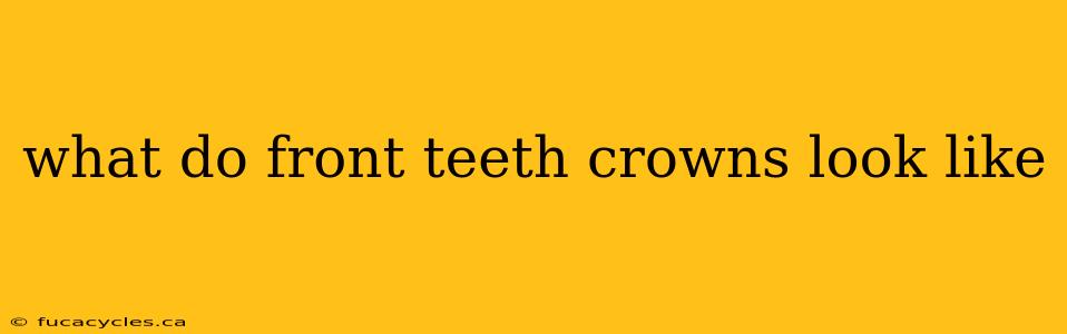 what do front teeth crowns look like