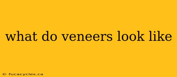 what do veneers look like