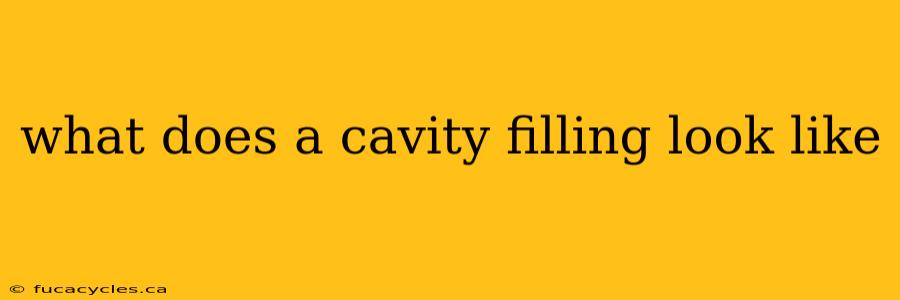 what does a cavity filling look like