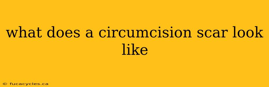 what does a circumcision scar look like