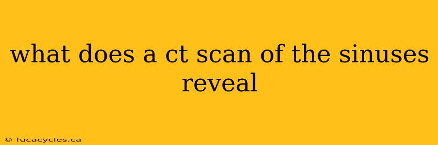 what does a ct scan of the sinuses reveal