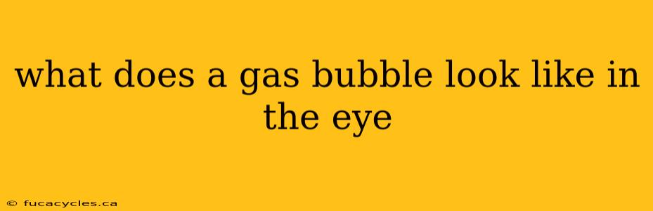 what does a gas bubble look like in the eye