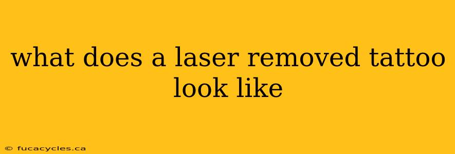 what does a laser removed tattoo look like