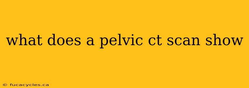 what does a pelvic ct scan show