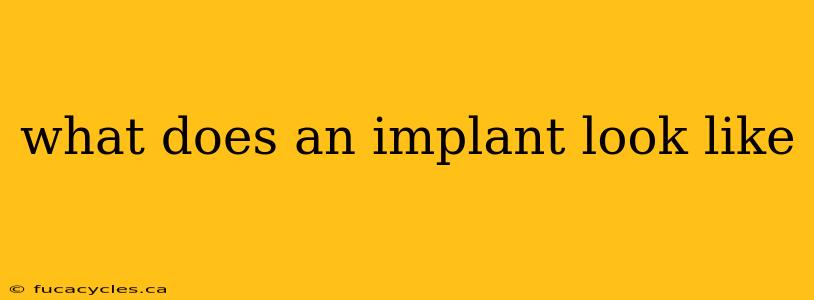 what does an implant look like