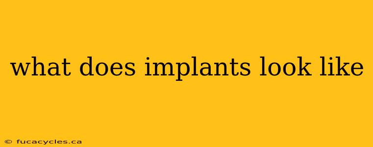 what does implants look like