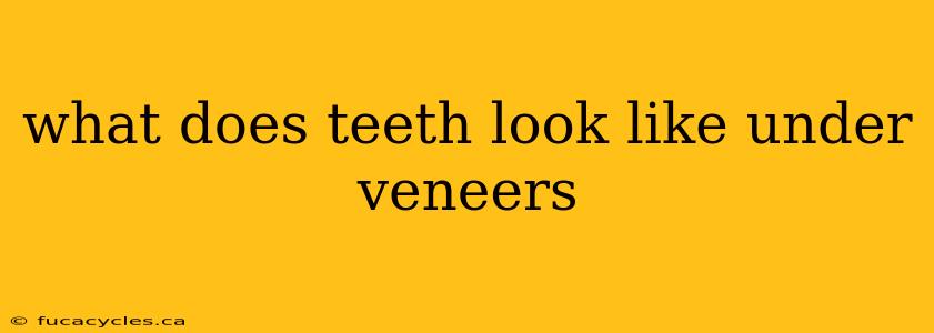 what does teeth look like under veneers