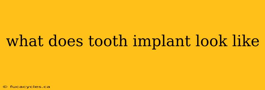 what does tooth implant look like