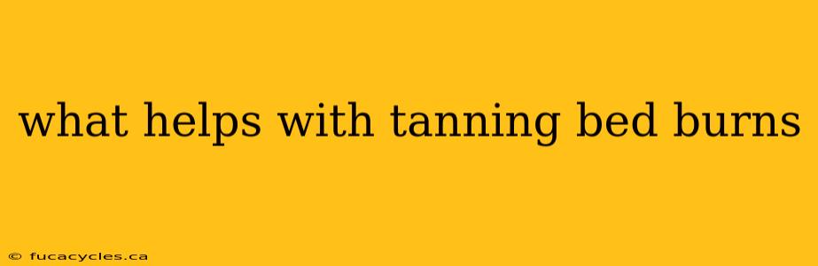 what helps with tanning bed burns