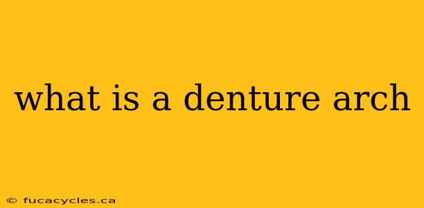 what is a denture arch