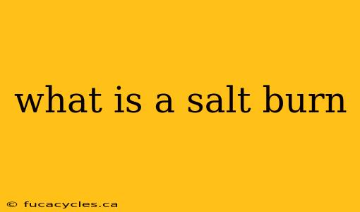 what is a salt burn