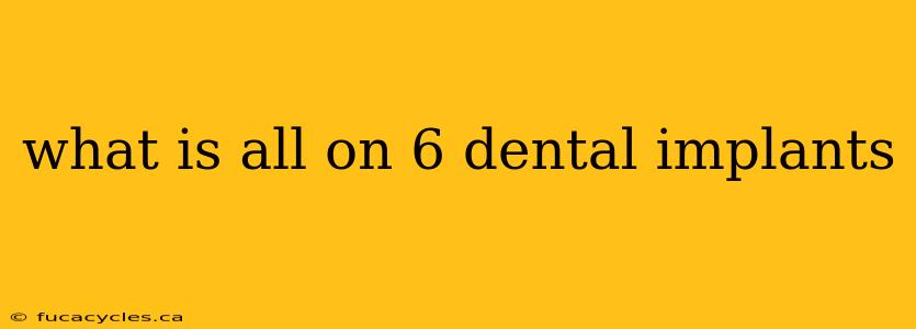 what is all on 6 dental implants