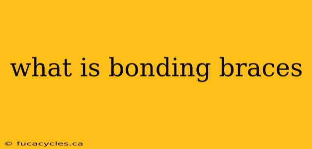 what is bonding braces