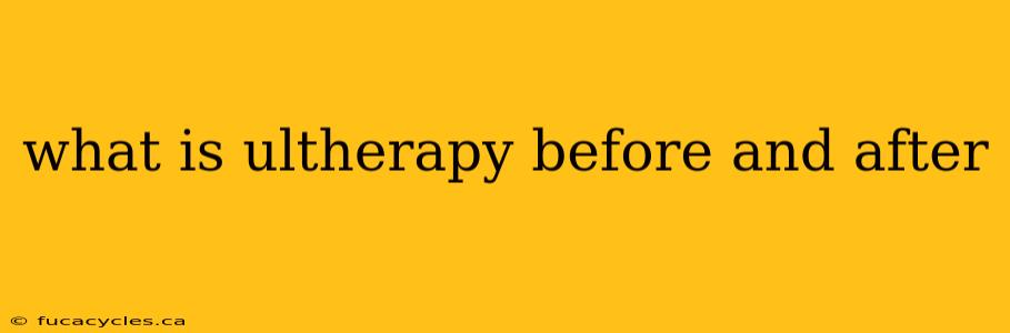 what is ultherapy before and after